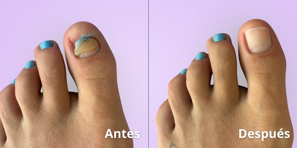 uñas acrílicas